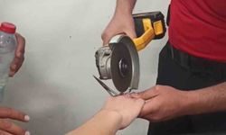 Parmağı makas halkasına sıkıştı, itfaiye kurtardı