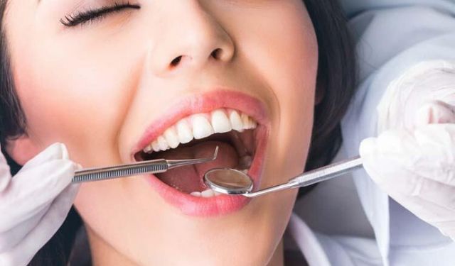 Diş taşı nedir ve neden olur? İşte diş taşlarıyla ilgili bilinmesi gerekenler
